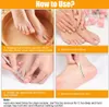 8 Stück Set Eingewachsene und Nagelfeile, Kit zur Produktbild-Vorschau 4