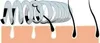 CHPN - Epilationsfeder - Epilation - Epilationsfeder - Produktbild-Vorschau 2