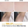 Dr. Melaxin – Spray exfoliant à l'acide kojique et au Voir les images du produit 4