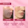 Crema Acnaut a tripla azione con retinolo e acido azelaico Anteprima dell’immagine prodotto 6
