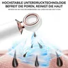 Elektrischer Mitesser-Entferner, 3 Saugstufen, 3 Produktbild-Vorschau 5
