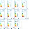 vidaXL Lampes murales extérieures 2 pcs. Acier inoxydable Voir les images du produit 9