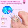 Nagelpilz Laser Gerät: Tragbar, USB-aufladbar, schmerzfrei Produktbild-Vorschau 6
