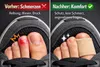 Zehen- & Fingerhülle – Anti-Reibung Zehenschützer gegen Produktbild-Vorschau 2