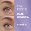 Augentropfen, Bausch+Lomb, Lumify, mit Brimonidintartrat 0, Produktbild-Vorschau 4