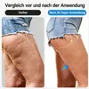 Schröpfmassagegerät, Anti Cellulite Massagegerät Produktbild-Vorschau 4