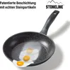 STONELINE® Set di pentole da 2 pezzi 20/26 | senza Anteprima dell’immagine prodotto 13