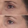 Murad Retinal ReSculpt Eye Treatment Produktbild-Vorschau 7