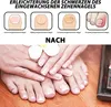 60 Stück Eingewachsene Zehennägel Set, Zehennagelkorrektur Produktbild-Vorschau 4