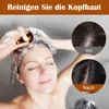 Kopfmassager mit 3 Knetmodi – IPX7 wasserdichter Produktbild-Vorschau 8