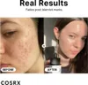 COSRX - The Niacinamide 15 Serum 20ml Náhled obrázku produktu 14