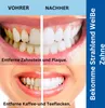 Zahnpflege-Set 4er Set für Zahnreinigung Zahnsteinentferner Produktbild-Vorschau 2