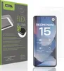 2x dipos FlexAR Xiaomi Redmi Note 15 Náhled obrázku produktu 1