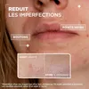 Mixa - Serum gegen Unreinheiten – für unreine Haut – Produktbild-Vorschau 4