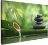 MuchoWow® - Leinwandbilder - Zen - Steine - Grün - Natur - Produktbild-Vorschau 1