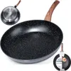 Padella in granito BLACK&WOOD 32 cm Anteprima dell’immagine prodotto 13