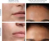 FOREO KIWI derma Gesichtspflegegerät mit sanfter Produktbild-Vorschau 5