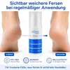 Blueline Schrundencreme 40% Urea, Fußcreme zum Hornhaut Produktbild-Vorschau 2