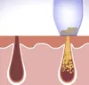 Derma Suction  - Mitesserentferner - Porensauger - Produktbild-Vorschau 5