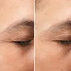 Medik8 - Crystal Retinal Ceramide Eye 6 - 15 ml Voir les images du produit 5
