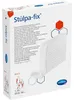 STÜLPA Fix Gr.3 Hand/Arm/Kdr.Kopf 25 m Netzschl. Produktbild-Vorschau 1