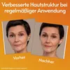 Vitamin C Serum Gesicht mit Hyaluron für Microneedling Produktbild-Vorschau 2
