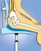 An anatomical illustration showing a person sitting on a blue seat cushion with a wedge shape, demonstrating proper posture and spinal alignment. Produktbild-Vorschau