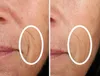 Shark Beauty CryoGlow LED-Maske und Kühlung der Augenpartie Produktbild-Vorschau 13
