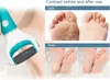 9er-Set Ersatzrollen für Scholl Velvet Smooth Pedi Produktbild-Vorschau 5