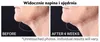 StriVectin Sérum tenseur pour le cou à bille 50ML Voir les images du produit 7