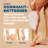 HornyFeet callus remover per la doccia | Lima per calli Anteprima dell’immagine prodotto 2
