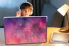 MuchoWow® Laptop Aufkleber Sticker Cover Aquarell - Rosa - Produktbild-Vorschau 3