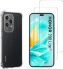A phone case and two screen protectors are displayed side-by-side against a white background. Anteprima dell’immagine prodotto