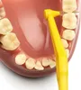 Tepe Angle Interdental Brushes 0,7 Yellow 25Pcs Produktbild-Vorschau 2