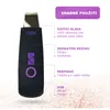 Kavitační ultrazvukový peelingový přístroj 2 v 1, Skin Náhled obrázku produktu 5