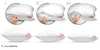 A collage of images showing how to adjust the filling of a pillow. Voir les images du produit