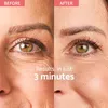 Remescar Instant Wrinkle Corrector 8ml Náhled obrázku produktu 5