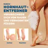 HornyFeet callus remover per la doccia | Lima per calli Anteprima dell’immagine prodotto 2