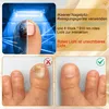 22 LED Nagelpilz Lasergerät,Nagelpilz Laser Produktbild-Vorschau 5