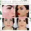 Vorher-Nachher-Vergleich des Gesichts einer Frau, das vollständige Abdeckung durch Make-up zeigt, das Akne, Rötungen, Narben und dunkle Flecken verdeckt Anteprima dell’immagine prodotto