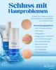 Blueline Creme bei Ekzem, Hautpilz, Psoriasis oder Produktbild-Vorschau 6