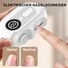 Elektrischer Nagelknipser für Senioren & Kinder – 4-in-1, 2 Produktbild-Vorschau 2
