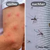 Fliegengitter Meterware – perfekter Insektenschutz für Ihr Produktbild-Vorschau 3