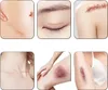 INF Strisce di silicone per cicatrici - 2 rotoli di nastro Anteprima dell’immagine prodotto 5