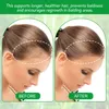 Rosmarinöl Ätherisches Öl 30ml Haarwachstum Kopfhaut Produktbild-Vorschau 4