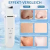 Ultraschall Skin Scrubber,4 Modi,Face Spatula Produktbild-Vorschau 6