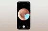 Bebird M9 S Smart Visual Ohrreiniger mit Kamera Schwarz Produktbild-Vorschau 4