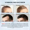 Collage of before and after images showing hair growth results, with accompanying text. Produktbild-Vorschau