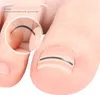 Close-up of a toe with an ingrown toenail correction patch applied. Anteprima dell’immagine prodotto