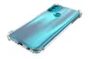 TPU Hülle Clear Armor Soft Case für Motorola Moto G71 5G Produktbild-Vorschau 5